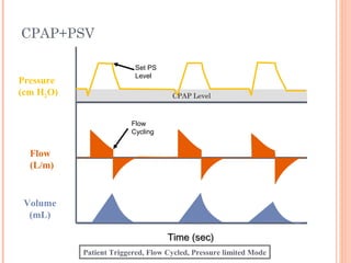 CPAP+PSV
Time (sec)Time (sec)
Flow
(L/m)
Pressure
(cm H2O)
Volume
(mL)
Set PS
Level
Flow
Cycling
Patient Triggered, Flow Cycled, Pressure limited Mode
CPAP Level
 