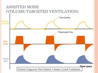 ASSISTED MODE
(VOLUME-TARGETED VENTILATION)
Flow
(L/m)
Pressure
(cm H2O)
Volume
(mL)
Patient Triggered, Flow limited, Volume Cycled Ventilation
Time (sec)
Preset peak Flow
Time Cycling
 