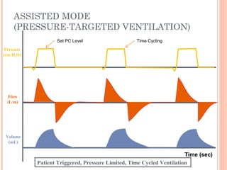 ASSISTED MODE
(PRESSURE-TARGETED VENTILATION)
Flow
(L/m)
Pressure
(cm H2O)
Volume
(mL)
Patient Triggered, Pressure Limited, Time Cycled Ventilation
Time (sec)
Time CyclingSet PC Level
 