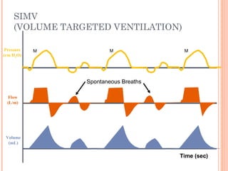 SIMV
(VOLUME TARGETED VENTILATION)
Flow
(L/m)
Pressure
(cm H2O)
Volume
(mL)
Spontaneous Breaths
M M M
Time (sec)
 