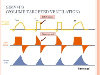 SIMV+PS
(VOLUME TARGETED VENTILATION)
Flow
(L/m)
Pressure
(cm H2O)
Volume
(mL)
M
TsuppTsynch
Set PS Level
Flow-cycled
Time (sec)
 