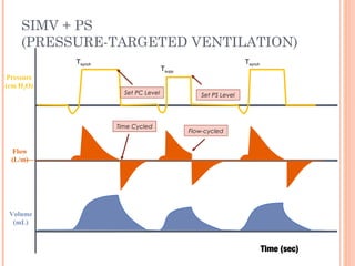 SIMV + PS
(PRESSURE-TARGETED VENTILATION)
Flow
(L/m)
Pressure
(cm H2O)
Volume
(mL)
Tsupp
Tsynch
Time Cycled
Flow-cycled
Tsynch
Set PC Level Set PS Level
Time (sec)
 