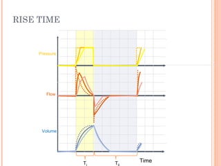 RISE TIME
Time
Flow
Pressure
Volume
T T
 