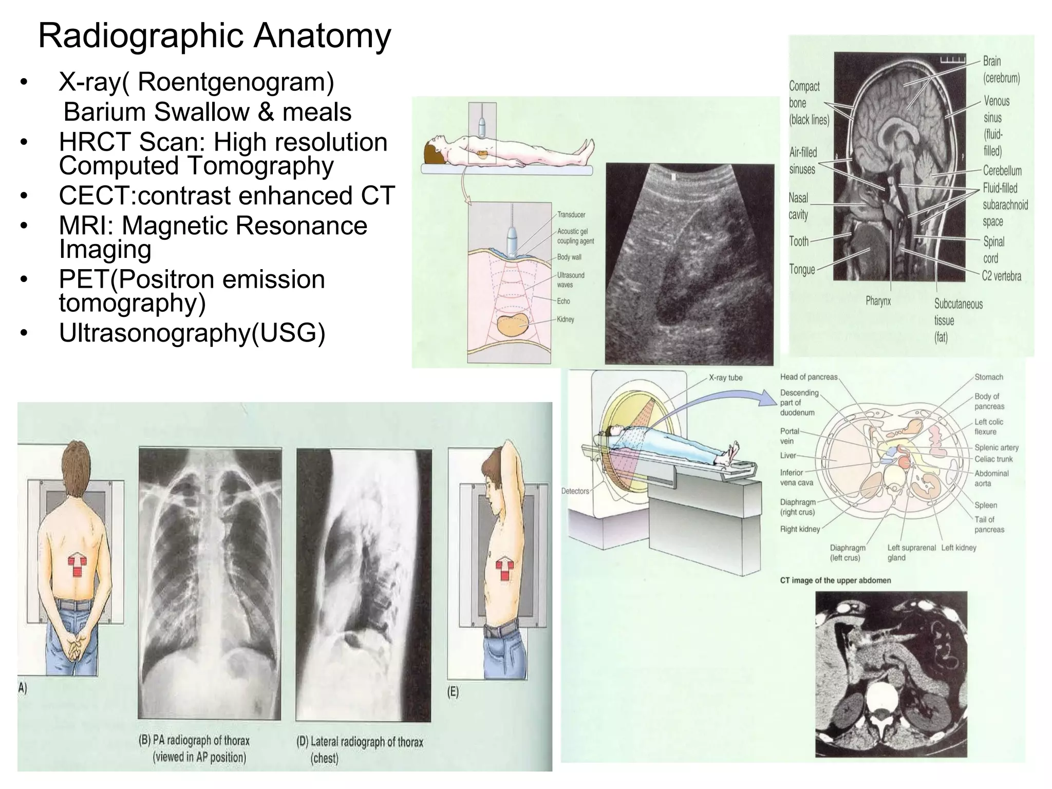 Radiographic Anatomy X-ray( Roentgenogram) Barium Swallow & meals HRCT Scan: High resolution Computed Tomography  CECT:contrast enhanced CT MRI: Magnetic Resonance Imaging PET(Positron emission tomography) Ultrasonography(USG) 