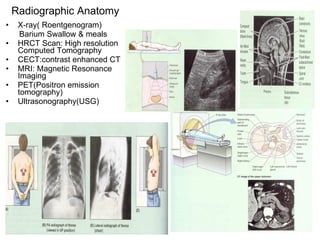 Radiographic Anatomy X-ray( Roentgenogram) Barium Swallow & meals HRCT Scan: High resolution Computed Tomography  CECT:contrast enhanced CT MRI: Magnetic Resonance Imaging PET(Positron emission tomography) Ultrasonography(USG) 