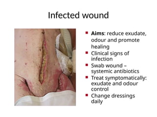 Infected wound
 Aims: reduce exudate,
odour and promote
healing
 Clinical signs of
infection
 Swab wound –
systemic antibiotics
 Treat symptomatically:
exudate and odour
control
 Change dressings
daily
 