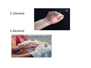 2. Chemical
3. Electrical
 