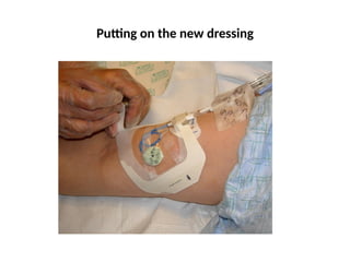 Putting on the new dressing
 