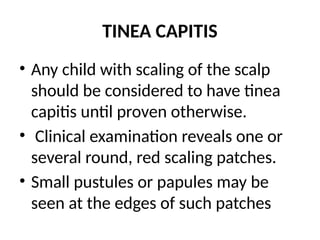 TINEA CAPITIS
• Any child with scaling of the scalp
should be considered to have tinea
capitis until proven otherwise.
• Clinical examination reveals one or
several round, red scaling patches.
• Small pustules or papules may be
seen at the edges of such patches
 
