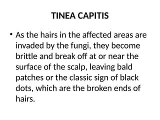 TINEA CAPITIS
• As the hairs in the affected areas are
invaded by the fungi, they become
brittle and break off at or near the
surface of the scalp, leaving bald
patches or the classic sign of black
dots, which are the broken ends of
hairs.
 