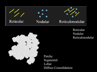 Patchy Reticular Pattern Basic X-Rays For Students; A radiology guide.pptx