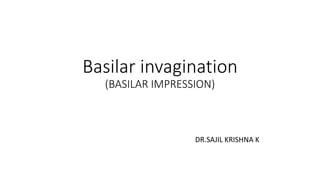 Basilar invagination
(BASILAR IMPRESSION)
DR.SAJIL KRISHNA K
 