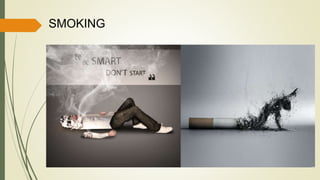 SMOKING
 