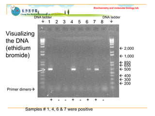 Biochemistry _ serum protein separation