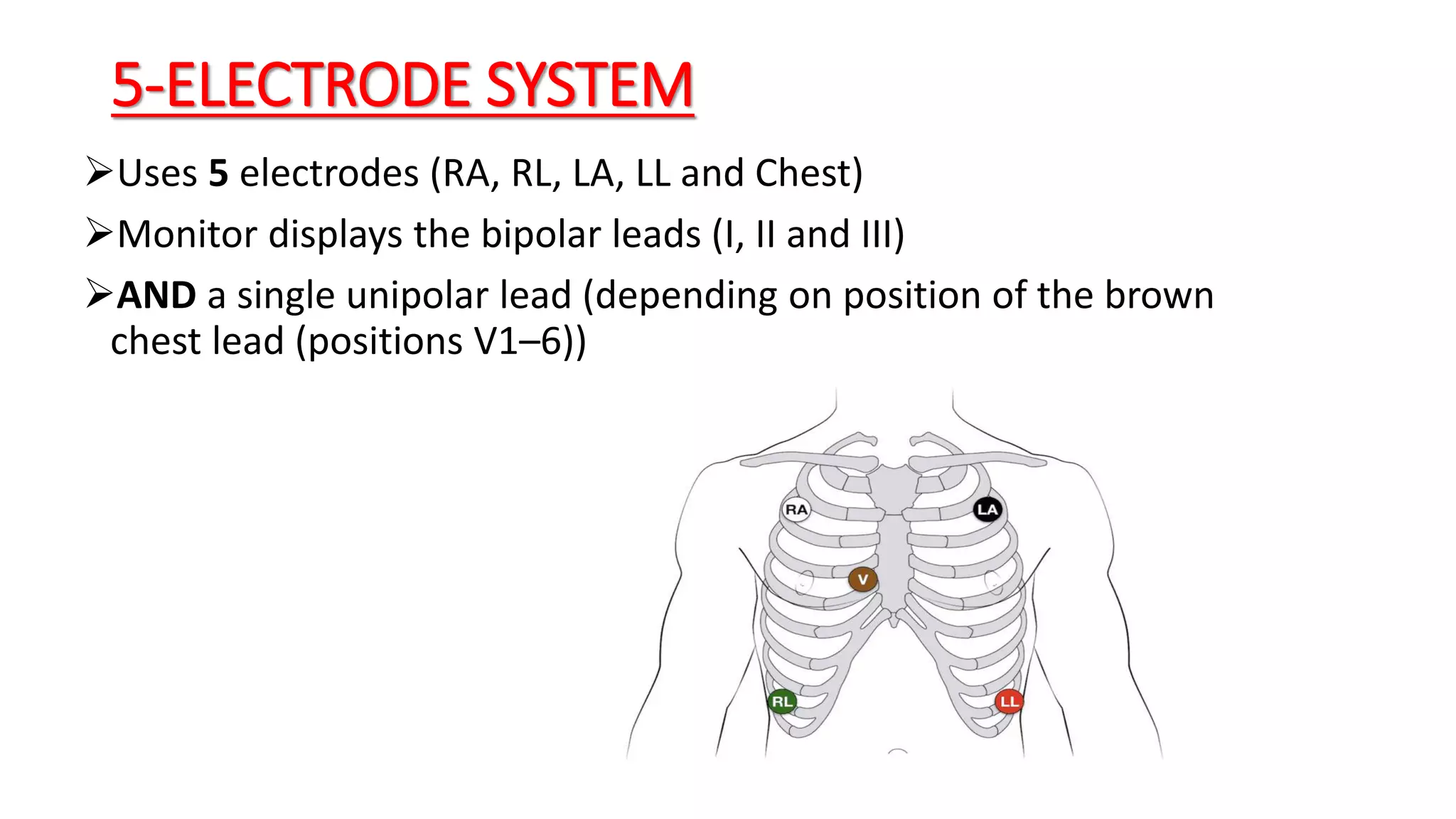 5-ELECTRODE SYSTEM
Uses 5 electrodes (RA, RL, LA, LL and Chest)
Monitor displays the bipolar leads (I, II and III)
AND a single unipolar lead (depending on position of the brown
chest lead (positions V1–6))
 