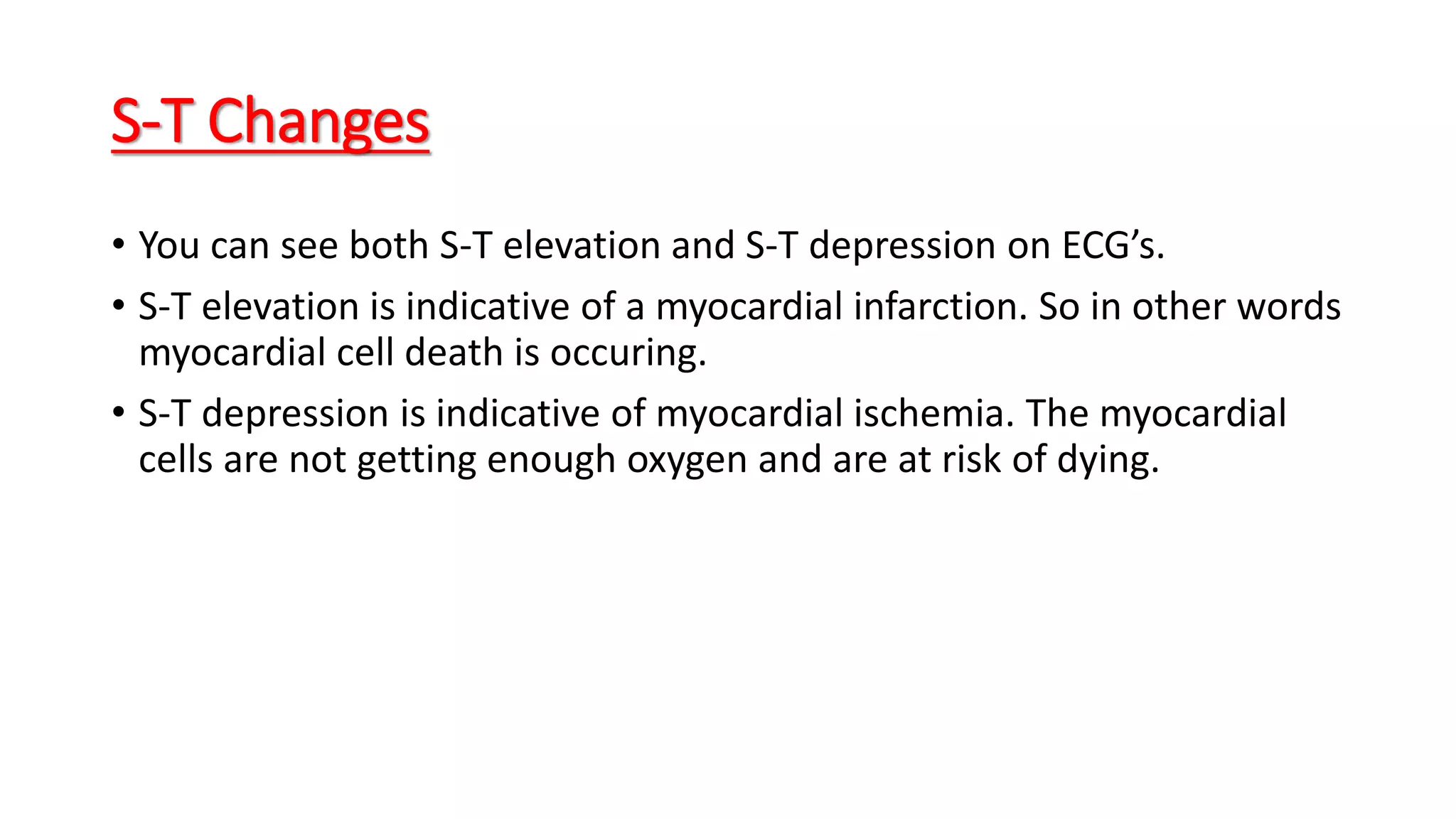 S-T Changes
• You can see both S-T elevation and S-T depression on ECG’s.
• S-T elevation is indicative of a myocardial infarction. So in other words
myocardial cell death is occuring.
• S-T depression is indicative of myocardial ischemia. The myocardial
cells are not getting enough oxygen and are at risk of dying.
 