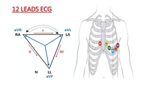 12 LEADS ECG
 