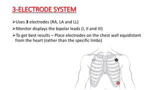 3-ELECTRODE SYSTEM
Uses 3 electrodes (RA, LA and LL)
Monitor displays the bipolar leads (I, II and III)
To get best results – Place electrodes on the chest wall equidistant
from the heart (rather than the specific limbs)
 