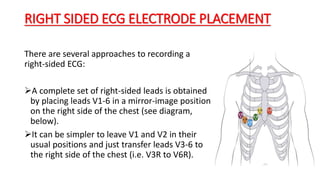 RIGHT SIDED ECG ELECTRODE PLACEMENT
There are several approaches to recording a
right-sided ECG:
A complete set of right-sided leads is obtained
by placing leads V1-6 in a mirror-image position
on the right side of the chest (see diagram,
below).
It can be simpler to leave V1 and V2 in their
usual positions and just transfer leads V3-6 to
the right side of the chest (i.e. V3R to V6R).
 