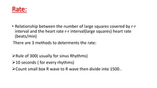 Rate:
• Relationship between the number of large squares covered by r-r
interval and the heart rate r-r interval(large squares) heart rate
(beats/min)
There are 3 methods to determents the rate:
Rule of 300( usually for sinus Rhythms)
10 seconds ( for every rhythms)
Count small box R wave to R wave then divide into 1500..
 