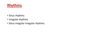 Rhythms
• Sinus rhythms
• Irregular rhythms
• Sinus irregular irregular rhythms.
 