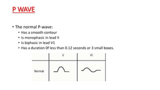 P WAVE
• The normal P-wave:
• Has a smooth contour
• Is monophasic in lead II
• Is biphasic in lead V1
• Has a duration 0f less than 0.12 seconds or 3 small boxes.
 