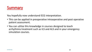 Summary
You hopefully now understand ECG interpretation.
• This can be applied in preoperative intraoperative and post operative
patient assessment.
• You can utilize this knowledge in courses designed to teach
arrhythmia treatment such as ILS and ALS and in your emergency
simulation courses.
10/26/2019 52
 