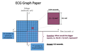 ECG Graph Paper
y
x
Voltage
(millivolts; mV)
Time (seconds; s)
y’
x’
(1  1) mm2
0.04 seconds
0.1 mV
Question: What would the bigger
square, i.e. the (5  5) mm2, represent?
Answer: 0.2 seconds.
‘X’ consider to
speed per
minute(time)
‘Y’ consider to
Amplitute(M.V)
 