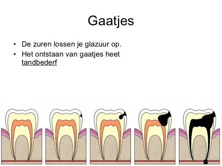 Basisstof 6, het gebit