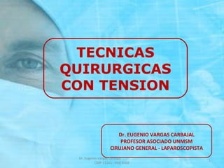 TECNICAS 
QUIRURGICAS 
CON TENSION 
Dr. EUGENIO VARGAS CARBAJAL 
PROFESOR ASOCIADO UNMSM 
CIRUJANO GENERAL - LAPAROSCOPISTA 
1 
Dr. Eugenio Vargas Carbajal 
CMP 11161 - RNE 4368 
 