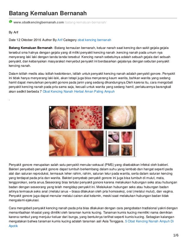 Batang kemaluan bernanah sakit saat kencing
