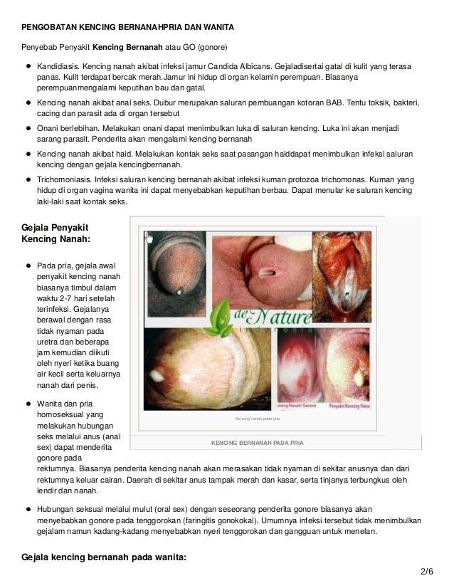 Batang kemaluan bernanah sakit saat kencing