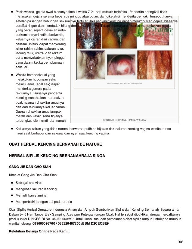 Batang kemaluan bernanah sakit saat kencing