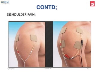 3)SHOULDER PAIN:
CONTD;
5/27/2023 GROUP 06 35
 