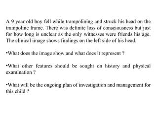 A 9 year old boy fell while trampolining and struck his head on the
trampoline frame. There was definite loss of consciousness but just
for how long is unclear as the only witnesses were friends his age.
The clinical image shows findings on the left side of his head.
•What does the image show and what does it represent ?
•What other features should be sought on history and physical
examination ?
•What will be the ongoing plan of investigation and management for
this child ?
 
