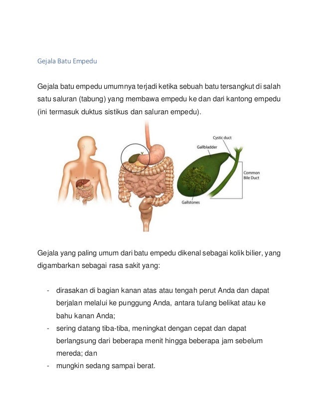 Cara Menghilangkan Batu Empedu Secara Alami