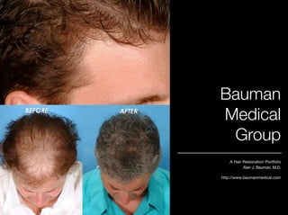 Bauman
Medical
 Group
    A Hair Restoration Portfolio
           Alan J. Bauman, M.D.

http://www.baumanmedical.com
 