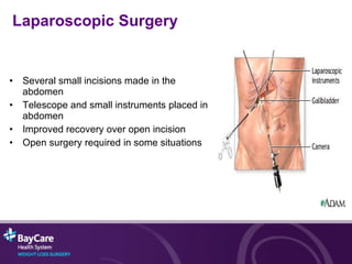 Several small incisions made in the abdomen Telescope and small instruments placed in abdomen  Improved recovery over open incision Open surgery required in some situations Laparoscopic Surgery 