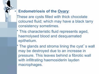 • Endometriosis of the Ovary:
These are cysts filled with thick chocolate
coloured fluid; which may have a black tarry
consistency sometimes.
* This characteristic fluid represents aged,
haemolysed blood and desquamated
epithelium.
* The glands and stroma lining the cyst’s wall
may be destroyed due to an increase in
pressure. This leaves behind a fibrotic wall
with infiltrating haemosiderin layden
macrophages.
 