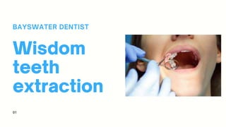 Wisdom
teeth
extraction
BAYSWATER DENTIST
01
 