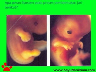 Apa peran lisosom pada proses pembentukan jari 
berikut? 
 