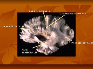 PARS FRONTALISPARS FRONTALIS
PARS PARIETALISPARS PARIETALIS
CENTRUM SEMIOVALECENTRUM SEMIOVALE
PARS OCCIPITALISPARS OCCIPITALIS
PARSPARS
TEMPORALISTEMPORALIS
 