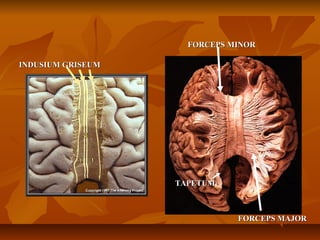 INDUSIUM GRISEUMINDUSIUM GRISEUM
FORCEPS MINORFORCEPS MINOR
FORCEPS MAJORFORCEPS MAJOR
TAPETUMTAPETUM
 