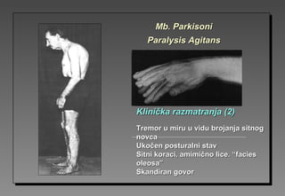 Klinička razmatranjaKlinička razmatranja (2)(2)
TremorTremor u miru u vidu brojanja sitnogu miru u vidu brojanja sitnog
novcanovca
Ukočen posturalni stavUkočen posturalni stav
Sitni koraci, amimično lice. “faciesSitni koraci, amimično lice. “facies
oleosa”oleosa”
Skandiran govorSkandiran govor
Mb. ParkisoniMb. Parkisoni
Paralysis AgitansParalysis Agitans
 