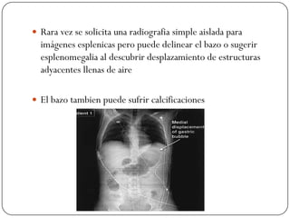  Rara vez se solicita una radiografia simple aislada para
  imágenes esplenicas pero puede delinear el bazo o sugerir
  esplenomegalia al descubrir desplazamiento de estructuras
  adyacentes llenas de aire

 El bazo tambien puede sufrir calcificaciones
 