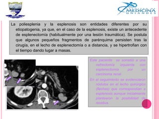La poliesplenia y la esplenosis son entidades diferentes por su
etiopatogenia, ya que, en el caso de la esplenosis, existe un antecedente
de esplenectomía (habitualmente por una lesión traumática). Se postula
que algunos pequeños fragmentos de parénquima persisten tras la
cirugía, en el lecho de esplenectomía o a distancia, y se hipertrofian con
el tiempo dando lugar a masas.
Este paciente se sometió a una
nefrectomía izquierda con
esplenectomía por un
carcinoma renal.
En el seguimiento se evidenciaron
nódulos en el lecho quirúrgico
(flechas) que correspondían a
esplenosis aunque inicialmente
plantearon la posibilidad de
recidiva.
 