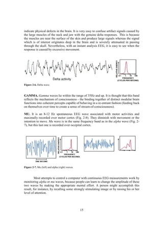indicate physical defects in the brain. It is very easy to confuse artifact signals caused by
the large muscles of the neck and jaw with the genuine delta responses. This is because
the muscles are near the surface of the skin and produce large signals whereas the signal
which is of interest originates deep in the brain and is severely attenuated in passing
through the skull. Nevertheless, with an instant analysis EEG, it is easy to see when the
response is caused by excessive movement.




Figure 2-6. Delta wave.



GAMMA. Gamma waves lie within the range of 35Hz and up. It is thought that this band
reflects the mechanism of consciousness - the binding together of distinct modular brain
functions into coherent percepts capable of behaving in a re-entrant fashion (feeding back
on themselves over time to create a sense of stream-of-consciousness).

MU. It is an 8-12 Hz spontaneous EEG wave associated with motor activities and
maximally recorded over motor cortex (Fig. 2-8). They diminish with movement or the
intention to move. Mu wave is in the same frequency band as in the alpha wave (Fig. 2-
7), but this last one is recorded over occipital cortex.




Figure 2-7. Mu (left) and alpha (right) waves.



         Most attempts to control a computer with continuous EEG measurements work by
monitoring alpha or mu waves, because people can learn to change the amplitude of these
two waves by making the appropriate mental effort. A person might accomplish this
result, for instance, by recalling some strongly stimulating image or by raising his or her
level of attention.




                                                 15
 