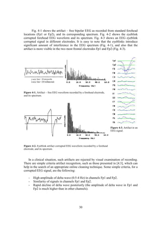 Fig. 4-1 shows the artifact – free bipolar EEG as recorded from standard forehead
locations (Fp1 or Fp2), and its corresponding spectrum. Fig. 4-2 shows the eyeblink
corrupted forehead EEG waveform and its spectrum. Fig. 4-3 shows an EEG eyeblink
corrupted signal in different electrodes. It is easy to note that the eyeblinks introduce
significant amount of interference in the EEG spectrum (Fig. 4-1), and also that the
artifact is more visible in the two most frontal electrodes Fp1 and Fp2 (Fig. 4-3).




Figure 4-1. Artifact – free EEG waveform recorded by a forehead electrode,
and its spectrum.




                                                                              Figure 4-3. Artifact in an
                                                                              EEG signal.




Figure 4-2. Eyeblink artifact corrupted EEG waveform recorded by a forehead
electrode, and its spectrum.



    In a clinical situation, such artifacts are rejected by visual examination of recording.
There are simple criteria artifact recognition, such as those presented in [4.3], which can
help in the search of an appropriate online cleaning technique. Some simple criteria, for a
corrupted EEG signal, are the following:

    -   High amplitude of delta wave (0.5-4 Hz) in channels Fp1 and Fp2.
    -   Similarity of signals in channels Fp1 and Fp2.
    -   Rapid decline of delta wave posteriorly (the amplitude of delta wave in Fp1 and
        Fp2 is much higher than in other channels).




                                                  30
 