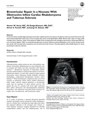 Case Report
Biventricular Repair in a Neonate With
Obstructive Inflow Cardiac Rhabdomyoma
and Tuberous Sclerosis
Hunter W. Hood, MS1
, Ali Dodge-Khatami, MD, PhD1
,
Aimee S. Parnell, MD2
, and Jorge D. Salazar, MD1
Abstract
A neonate with prenatally diagnosed large intracardiac rhabdomyomas and suspicion of tuberous sclerosis presented at birth with
severe ductal-dependent obstruction at the tricuspid valve and an atrial septal defect (ASD). Biventricular repair at 9 days of life
included tumor resection, repair of the posterior leaflet of the tricuspid valve with autologous pericardium, fenestrated ASD clo-
sure, and ductus ligation. After an uneventful postoperative recovery, follow-up echocardiography at two months showed excel-
lent results with tricuspid valve competency and normal biventricular function. Overall prognosis will probably depend on issues
pertaining to tuberous sclerosis.
Keywords
cardiac tumors, tricuspid valve, neonate
Submitted October 3, 2014; Accepted November 3, 2014.
Introduction
Although primary cardiac tumors are rare in the pediatric pop-
ulation, intracardiac rhabdomyomas are most frequently seen
in neonates and infants and often associated with tuberous
sclerosis.1-3
Spontaneous regression of intracardiac rhabdo-
myomas without medical or surgical intervention is well docu-
mented and common. As such, only a minority require surgical
intervention, whose indications include medically refractory
dysrhythmia, compromised hemodynamic function, and/or
hydrops.4-6
When hemodynamic compromise does occur from
systemic or pulmonary inflow and/or outflow obstruction,
either single ventricle surgical palliation or biventricular
repair may be necessary to allow patient survival. We
present the case of a neonate with severe right ventricular
(RV) inflow obstruction and ductal-dependent pulmonary
blood flow, who underwent successful tumor resection, tri-
cuspid valve reconstruction, and biventricular repair.
Case Report
At 31 weeks of gestation, a prenatal ultrasound identified
multiple intracardiac tumors (suspected cardiac rhabdomyo-
mas) in a female fetus, including one large right atrial tumor
that appeared adherent to the tricuspid valve (Figure 1).
Fetal magnetic resonance imaging identified two possible
subependymal nodules and four rhabdomyomas, one of
1
Pediatric and Congenital Heart Surgery, Children’s Heart Center, University
of Mississippi Medical Center, Jackson, MS, USA
2
Pediatric and Fetal Cardiology, Children’s Heart Center, University of
Mississippi Medical Center, Jackson, MS, USA
Corresponding Author:
Ali Dodge-Khatami, Division of Pediatric and Congenital Heart Surgery, Batson
Children’s Hospital, University of Mississippi Medical Center, 2500 North State
Street, Room S345, Jackson, MS 39216, USA.
Email: adodgekhatami@umc.edu
Figure 1. Prenatal fetal ultrasound at 31 gestational weeks, showing
the intracardiac masses and largest tumor attached to the tricuspid
valve. RA indicates right atrium; LA, left atrium; Rh, rhabdomyoma.
World Journal for Pediatric and
Congenital Heart Surgery
2015, Vol. 6(2) 307-310
ª The Author(s) 2014
Reprints and permission:
sagepub.com/journalsPermissions.nav
DOI: 10.1177/2150135114561689
pch.sagepub.com
 