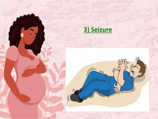 3) Seizure